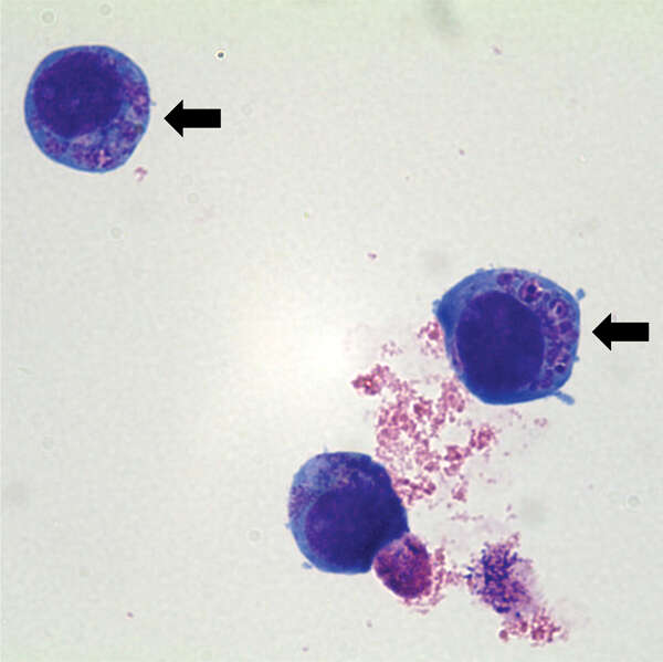 Image of Anaplasma
