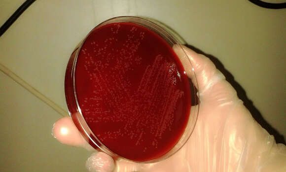 Image of Campylobacter jejuni