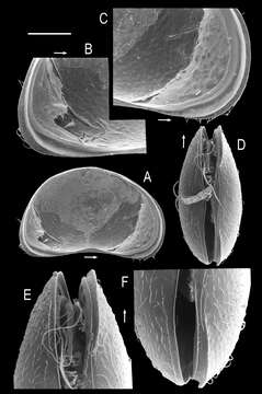 Image of Potamocypris arcuata