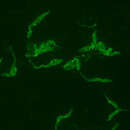 Image of Trypanosoma cruzi