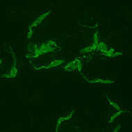 Image of Trypanosoma subgen. Schizotrypanum