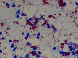 Image of Hansen’s coccus spirilly