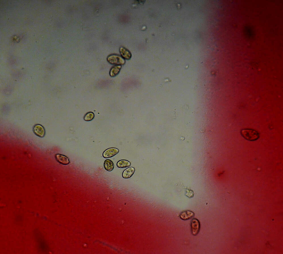 Image of ciliates