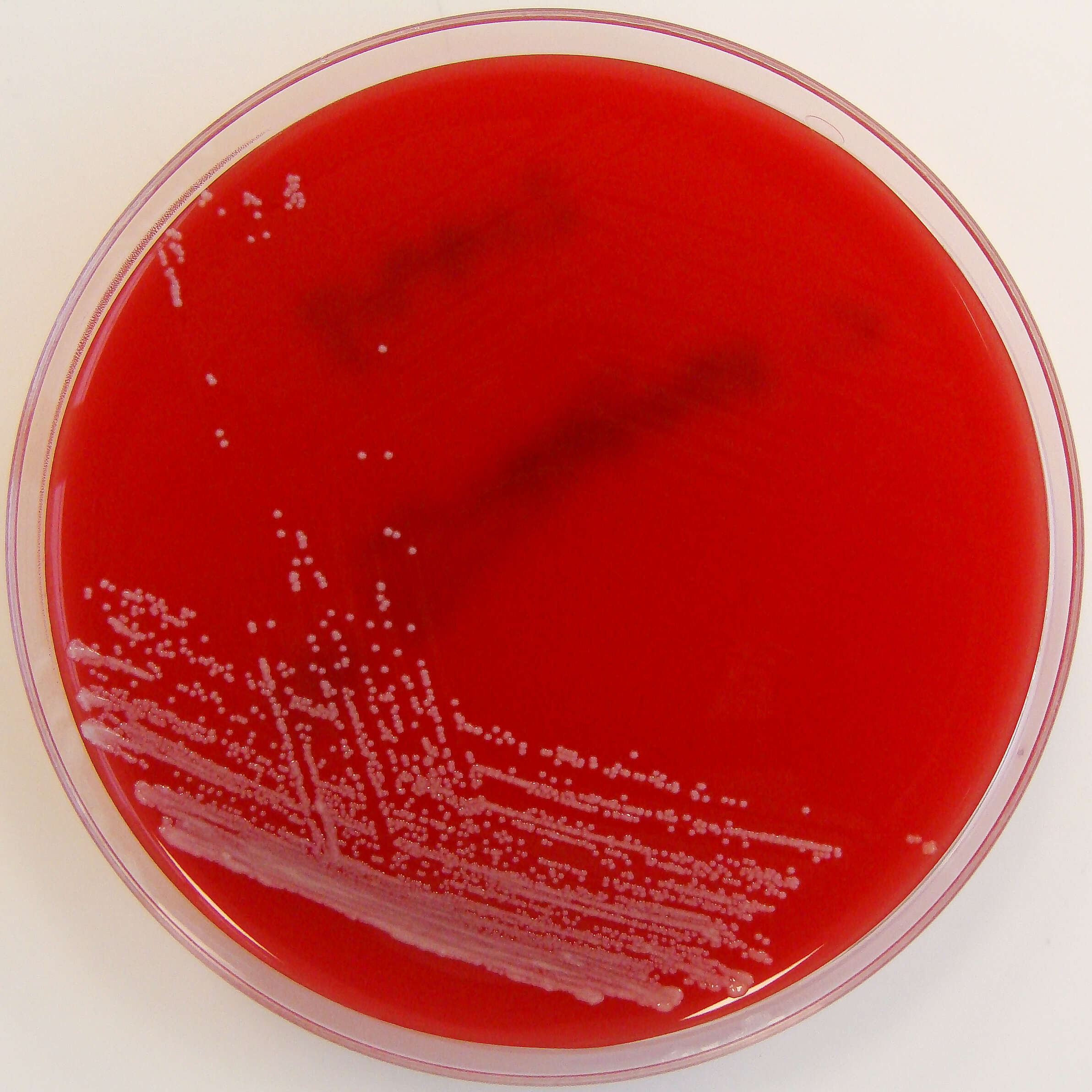 Sivun Corynebacterium striatum kuva