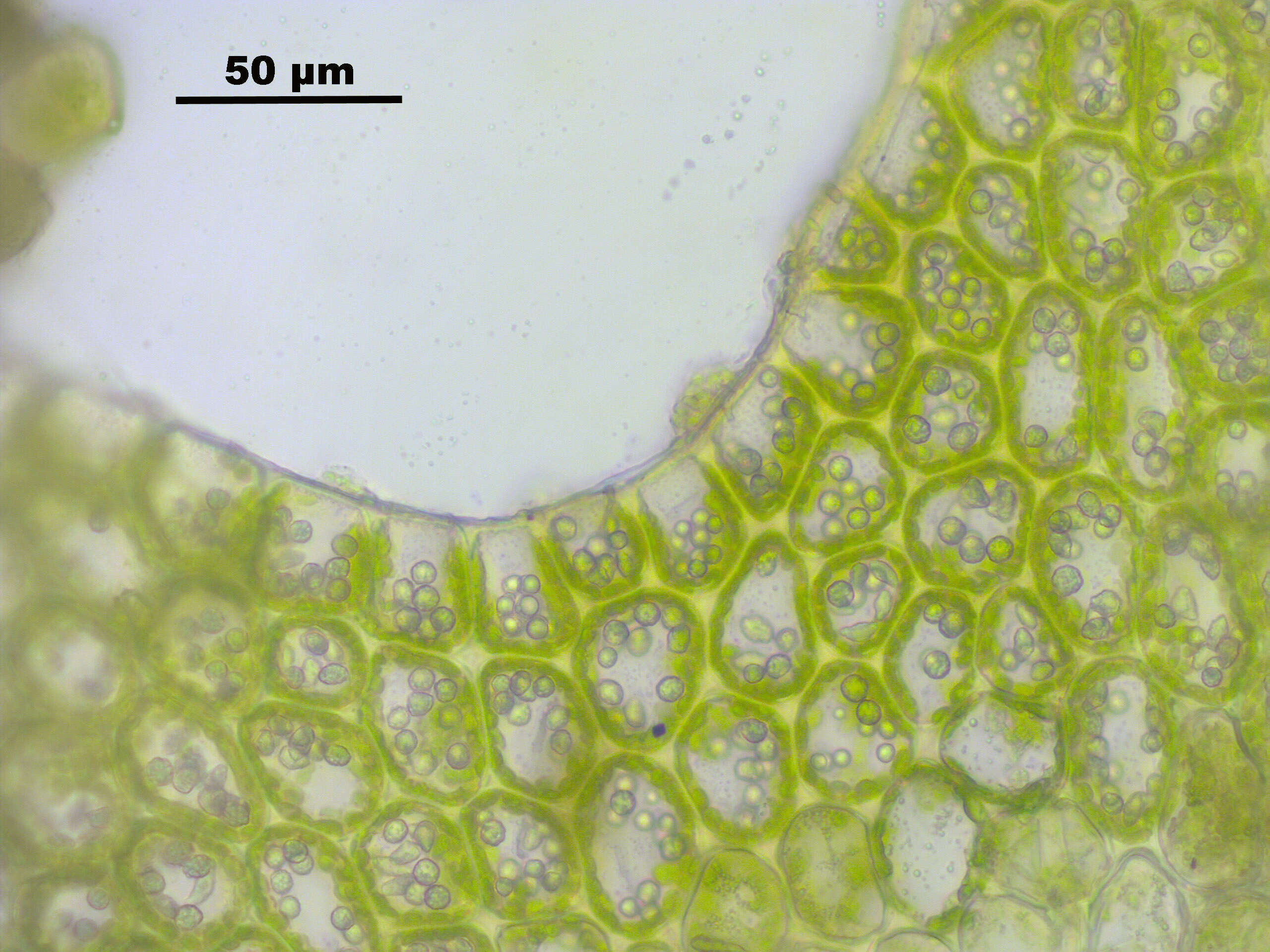 Image of Lophoziopsis longidens (Lindb.) Konstant. & Vilnet
