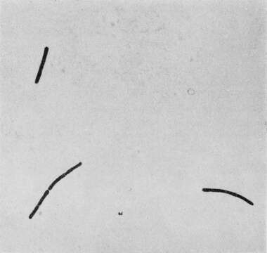 Image de Bacillus anthracis