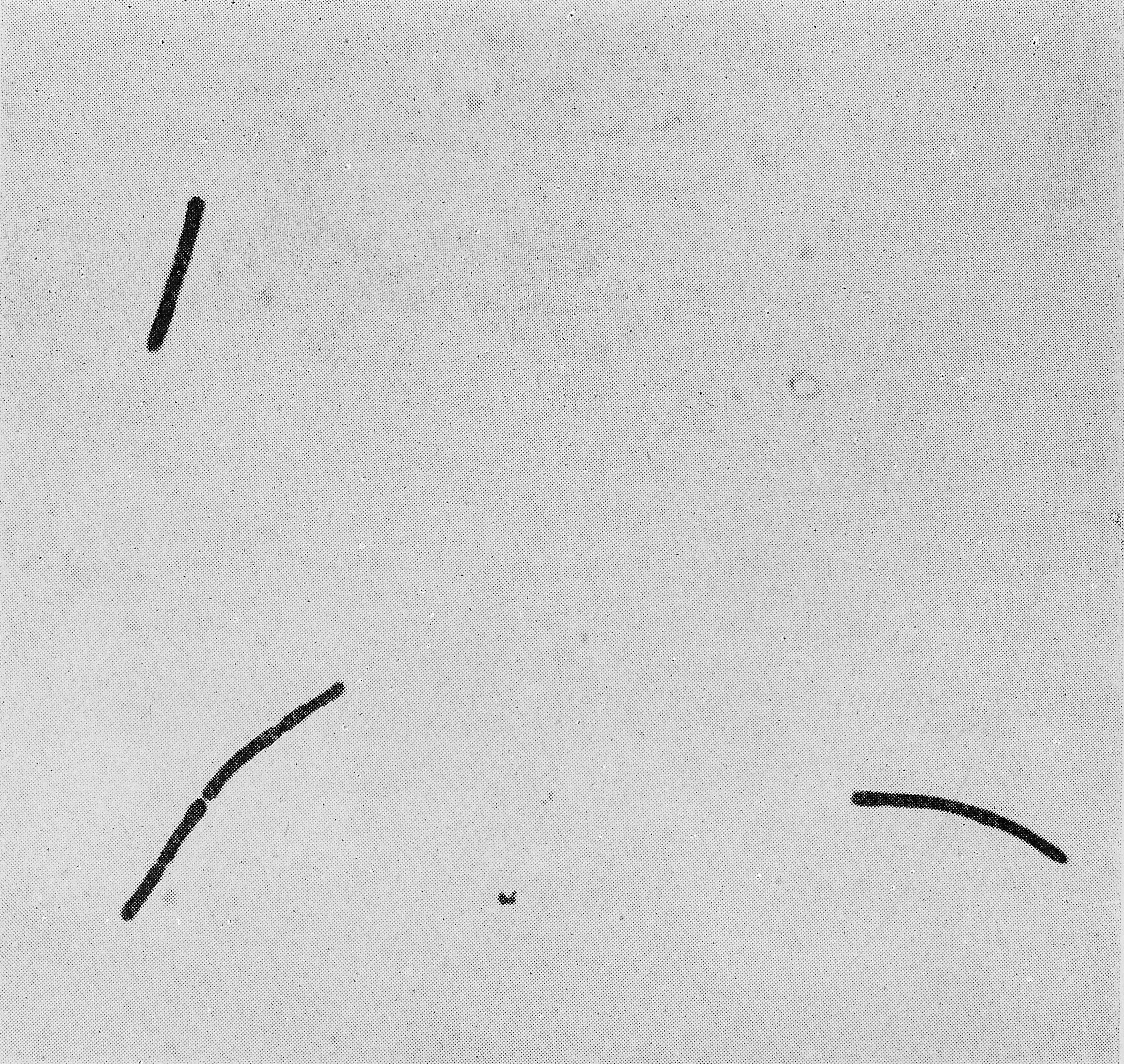 Image of Bacillus anthracis