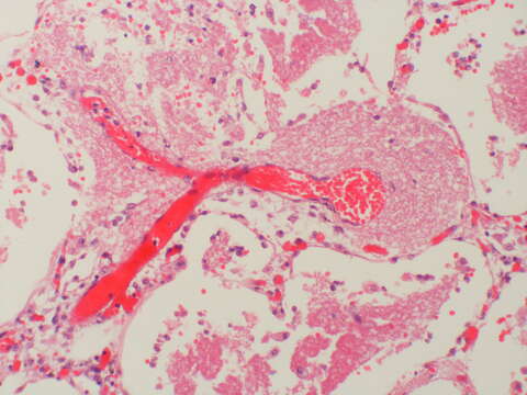 Image of Pneumocystomycetes