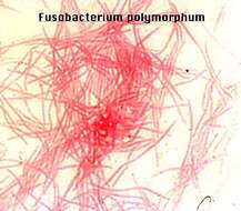 Sivun Fusobacterium kuva