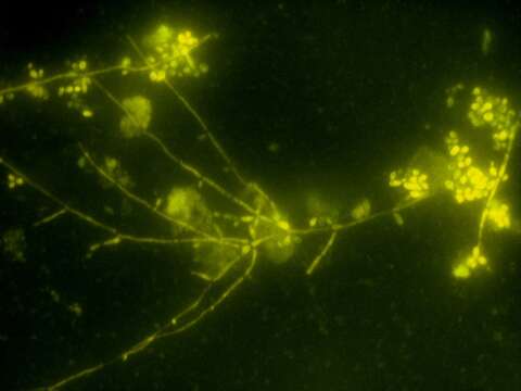 Imagem de Candida albicans (C. P. Robin) Berkhout 1923