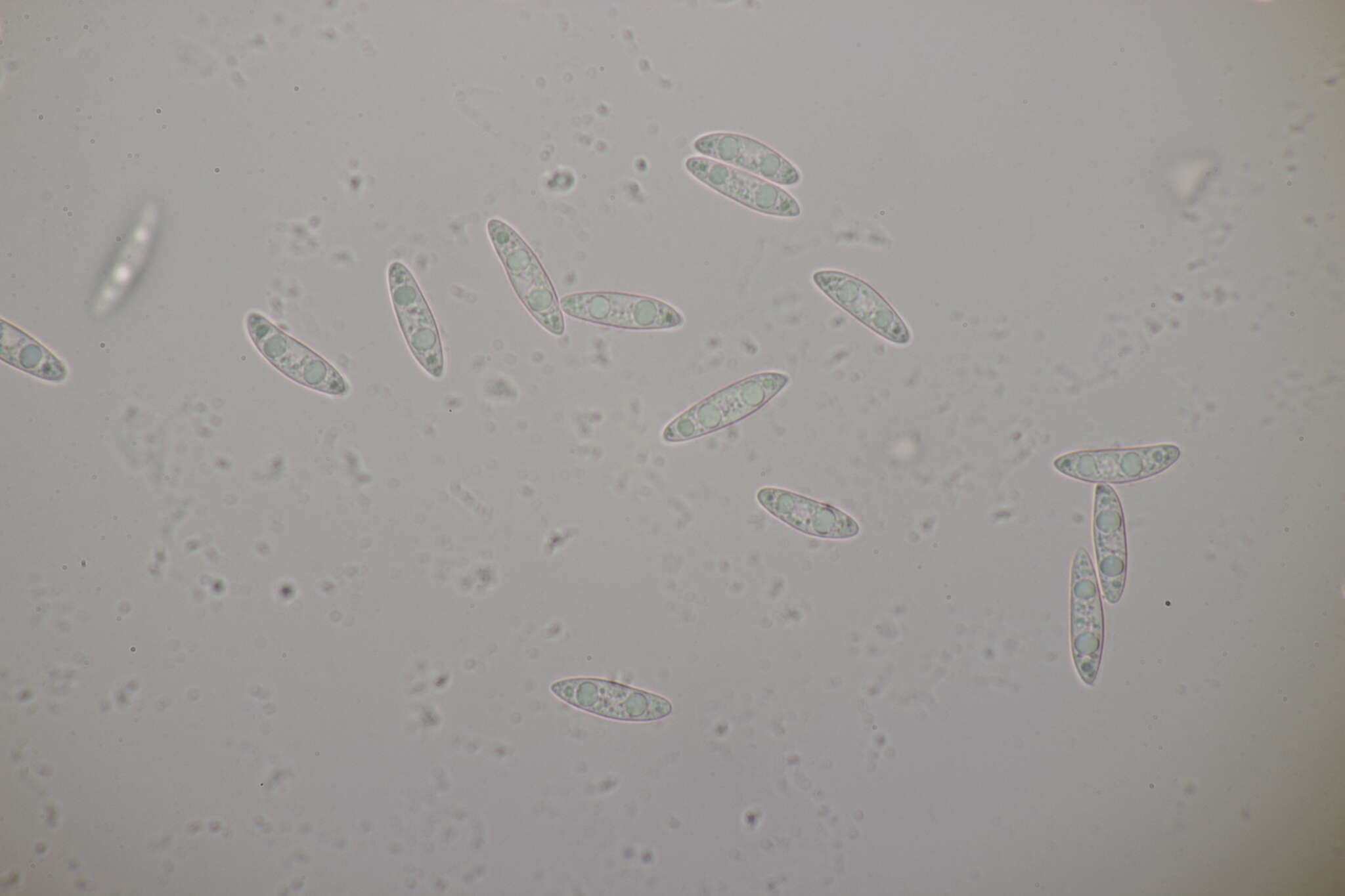 Image of Ascocoryne