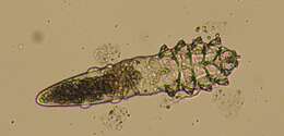 Imagem de Demodex folliculorum Simon 1842