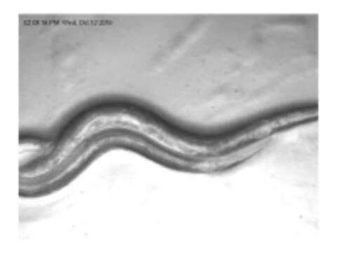 Image of Roundworm