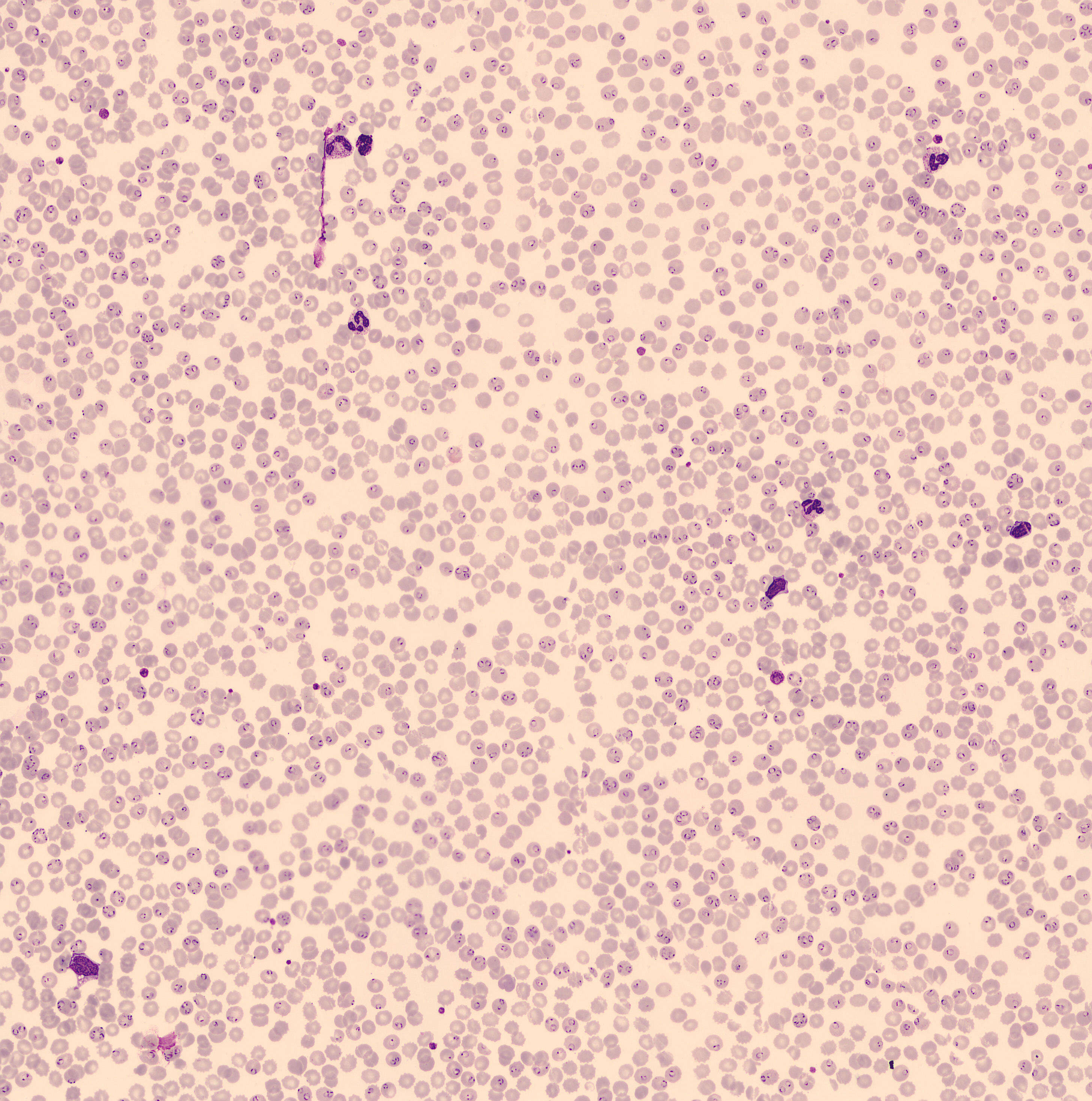 Image of Plasmodium