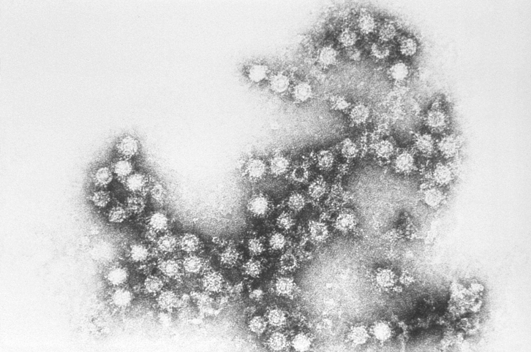 Image of Enterovirus