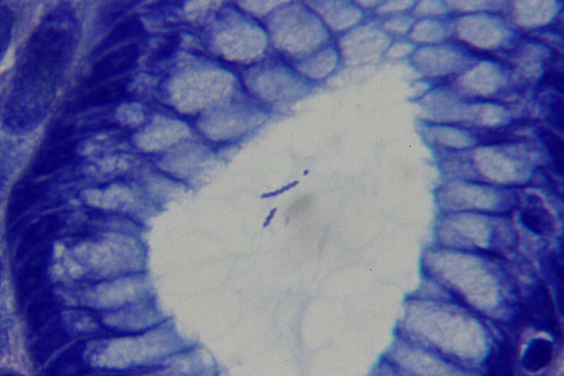 Image de Helicobacter heilmannii