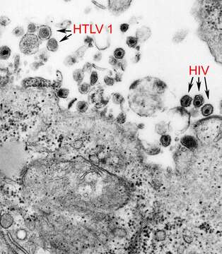 Image de Deltaretrovirus