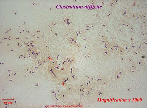 Image de Clostridioides difficile