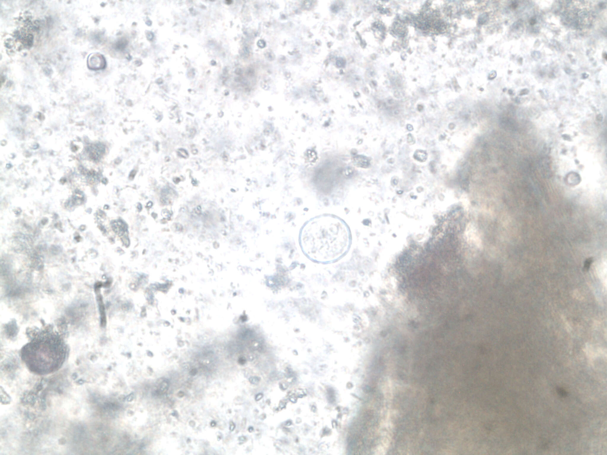 Image of Entamoeba coli