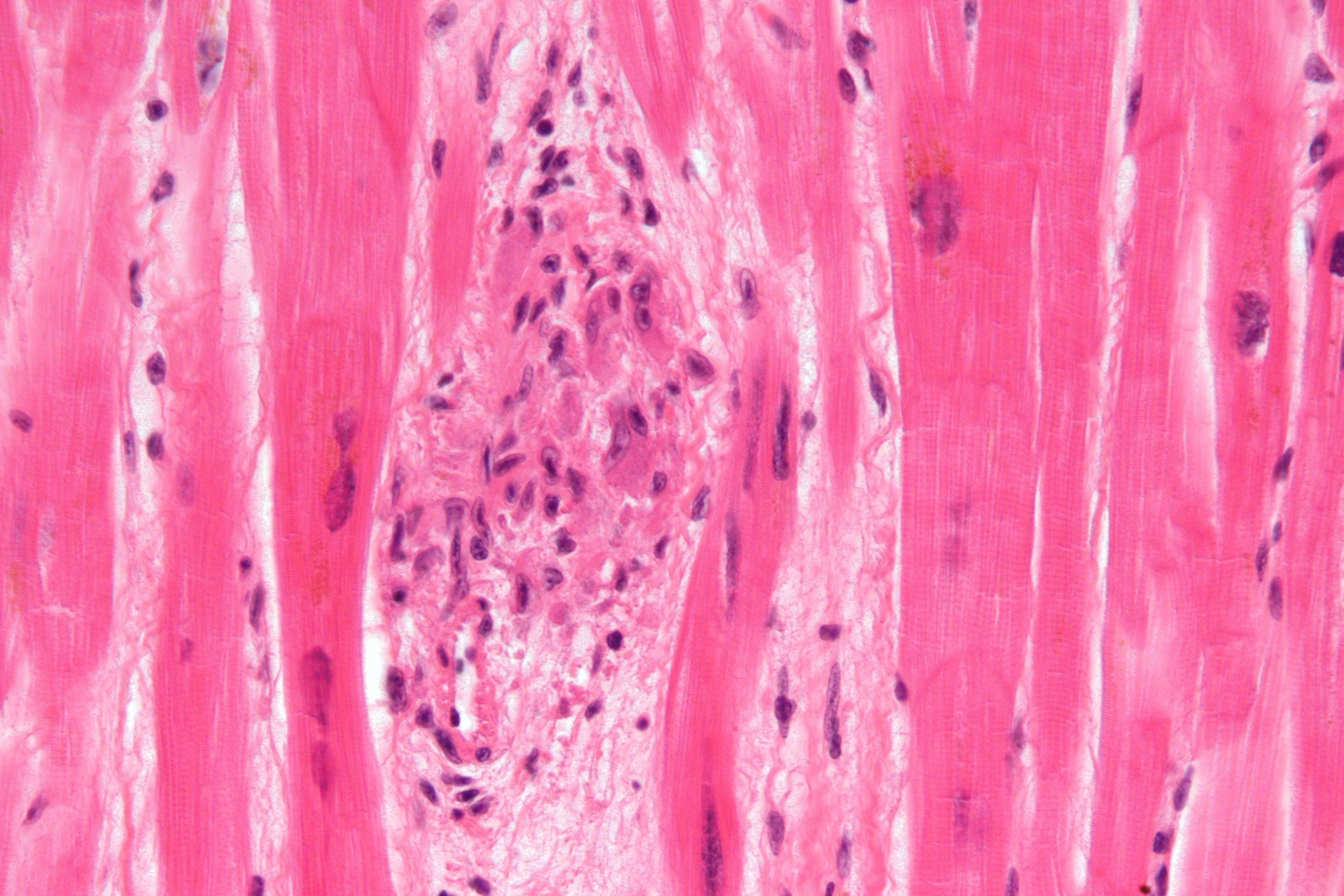 Image of Streptococcus pyogenes