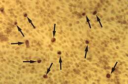 Image of Chlamydia trachomatis