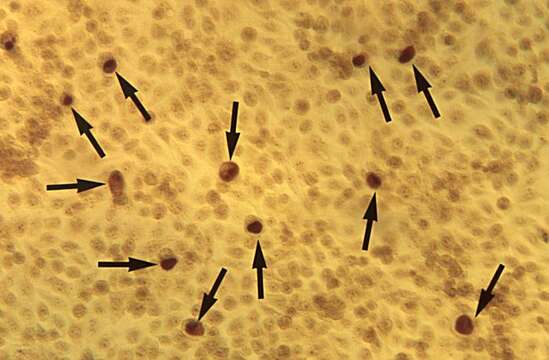 Chlamydia trachomatis resmi