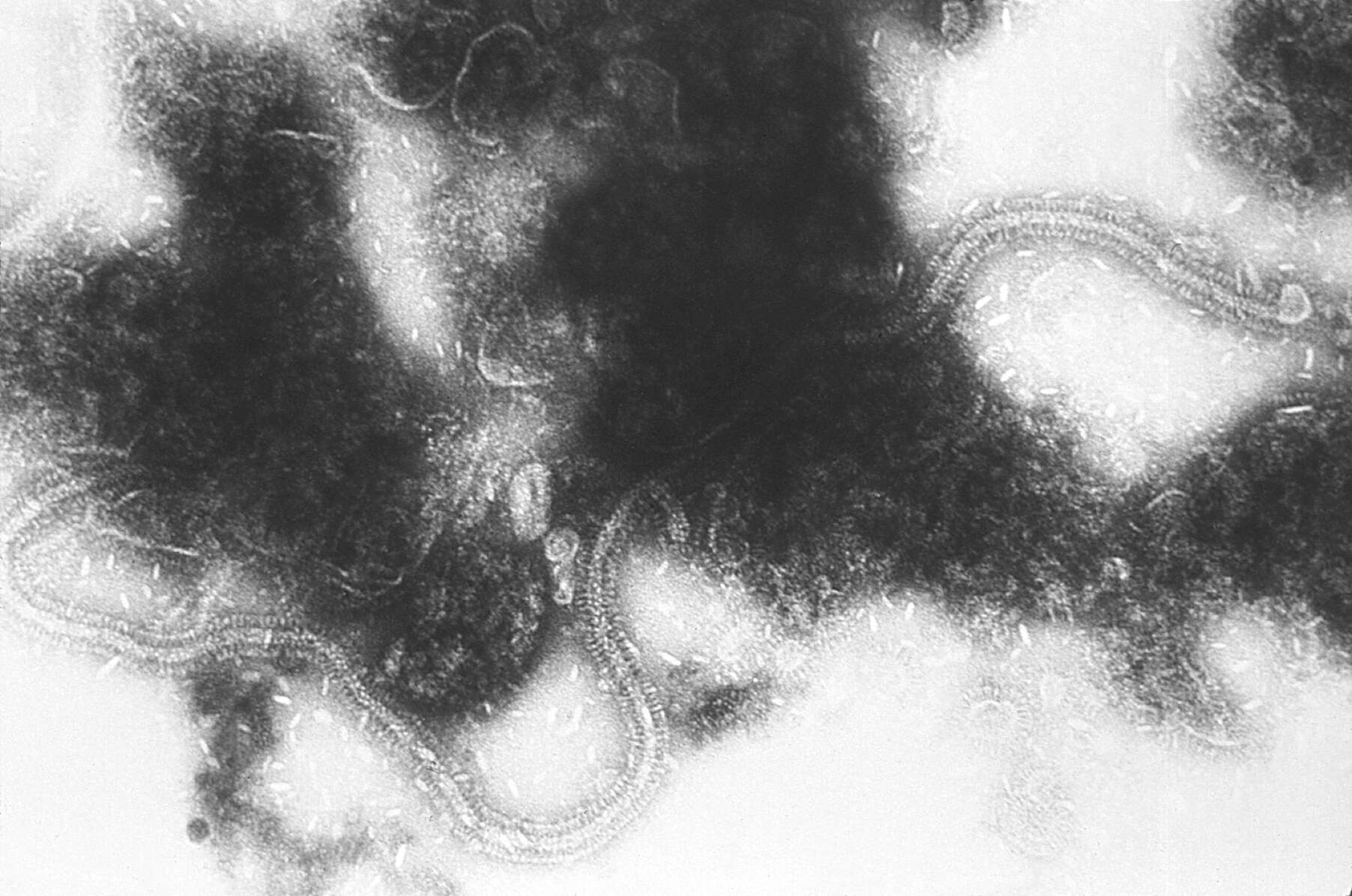 Image de Human respiratory syncytial virus
