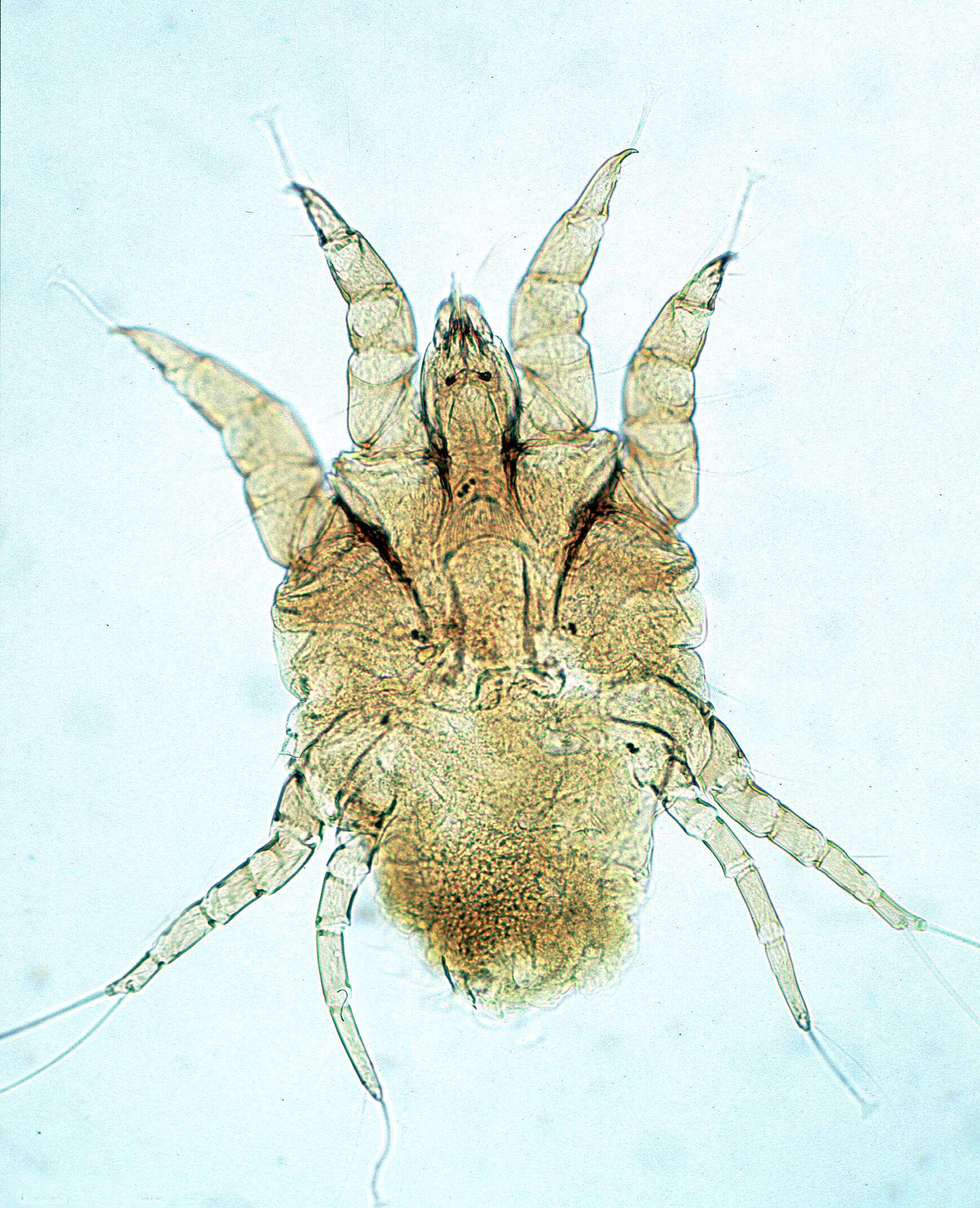 Image of Psoroptes