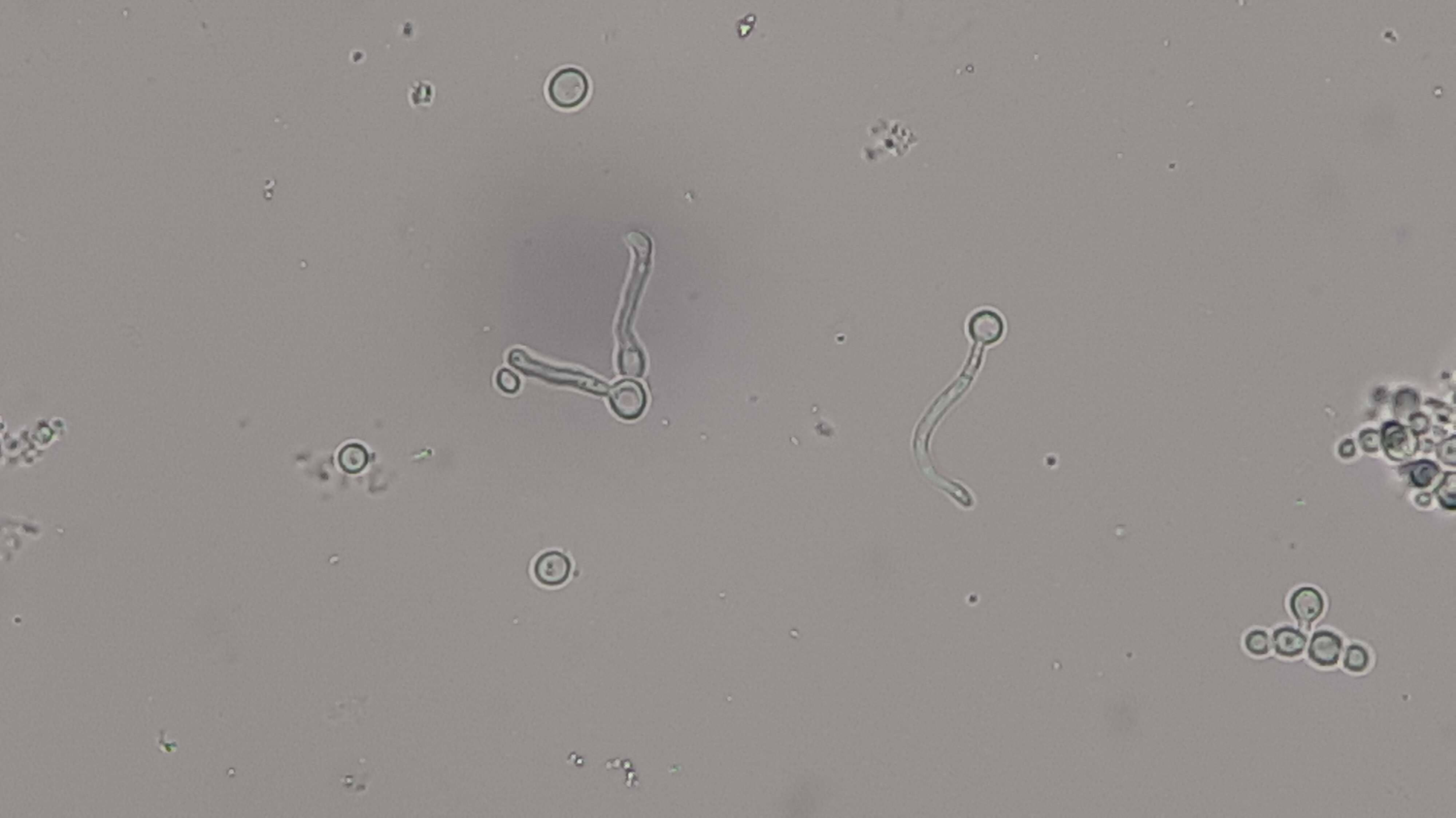 Image of unclassified Saccharomycetales