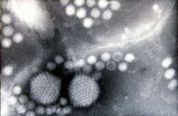 Image of Dependovirus