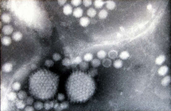 Image of Adeno-associated virus 2