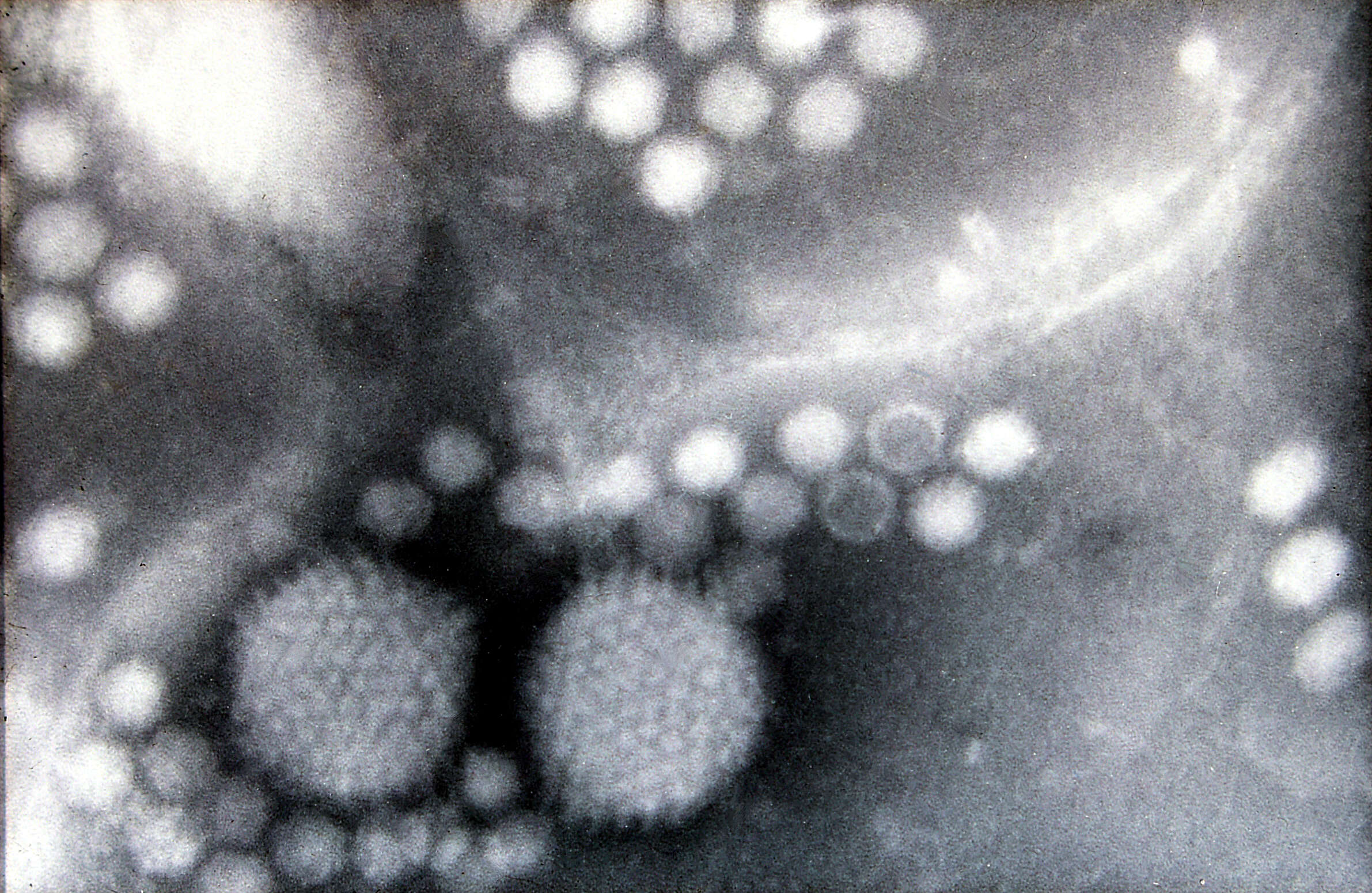 Слика од Dependoparvovirus