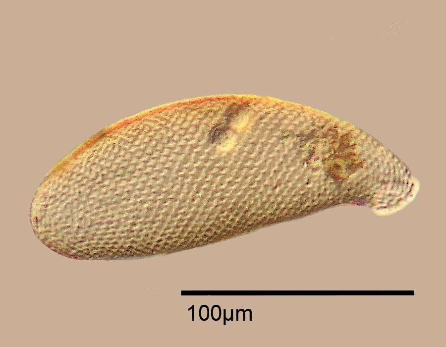 Слика од Cyphoderiidae