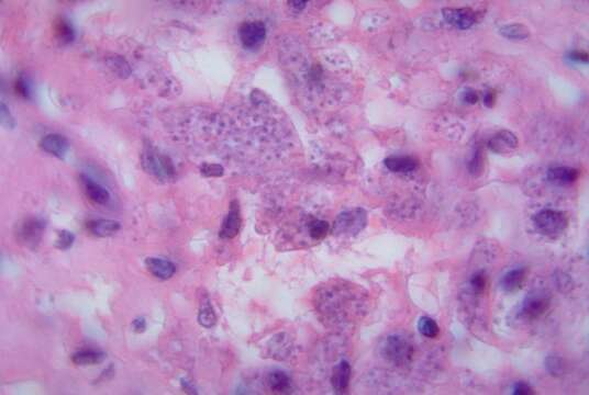 Image of Leishmania donovani