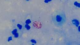 Image of Hansen’s coccus spirilly