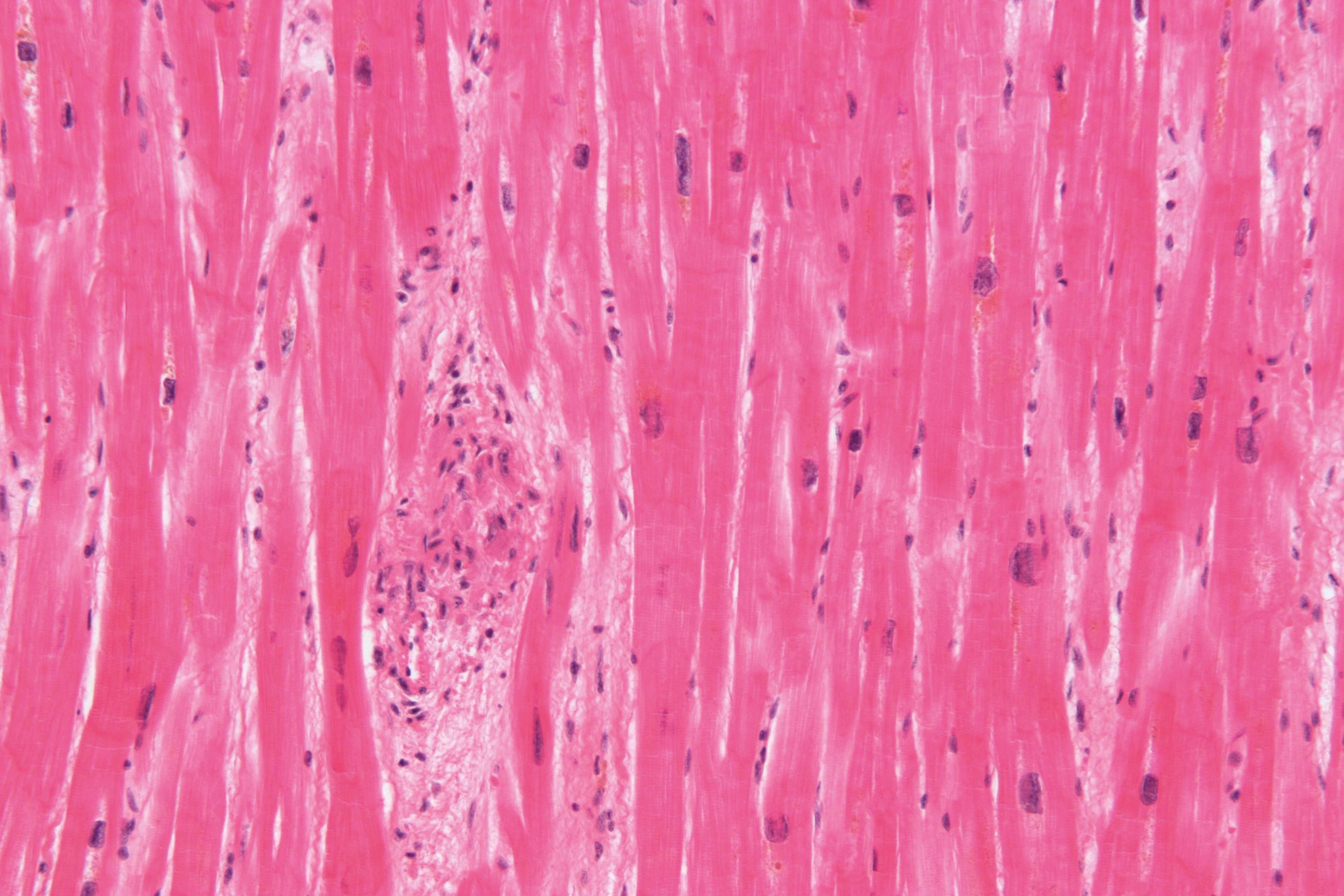 Image of Streptococcus pyogenes