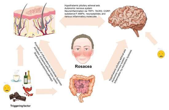 Imagem de Rosacea Quoy & Gaimard 1827