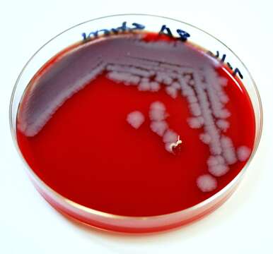 Image of Bacillus anthracis