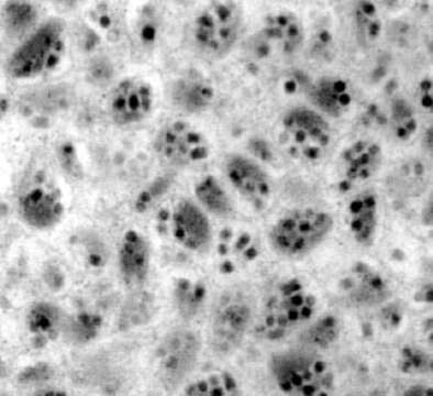 Image of Polydnavirus
