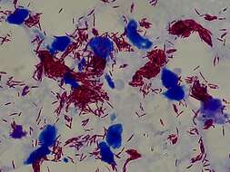 Image of Mycobacterium