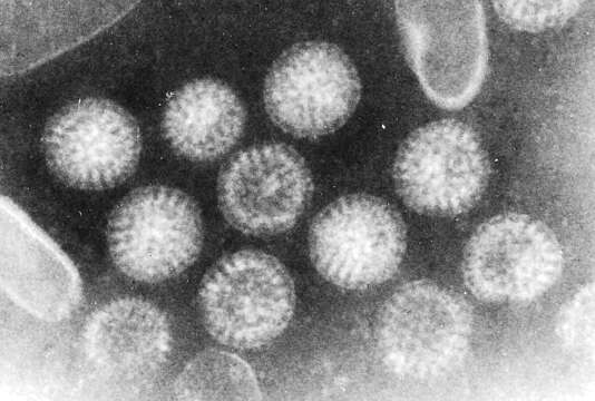 Sivun Rotavirus kuva