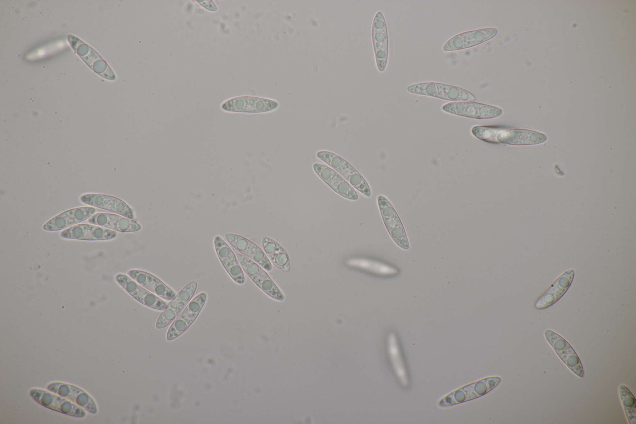 Image of Ascocoryne