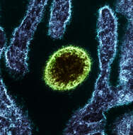 Image of Nipah virus