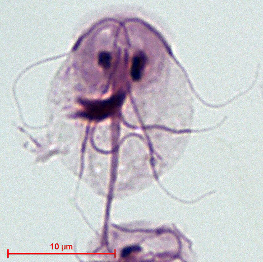 Imagem de Giardia intestinalis