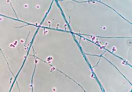 Image of Scedosporium prolificans (Hennebert & B. G. Desai) E. Guého & de Hoog 1991