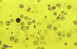 Image of Plasmodium berghei