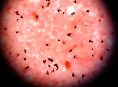 Image of coryneform bacteria