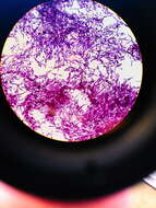 Image of Bacillus thuringiensis