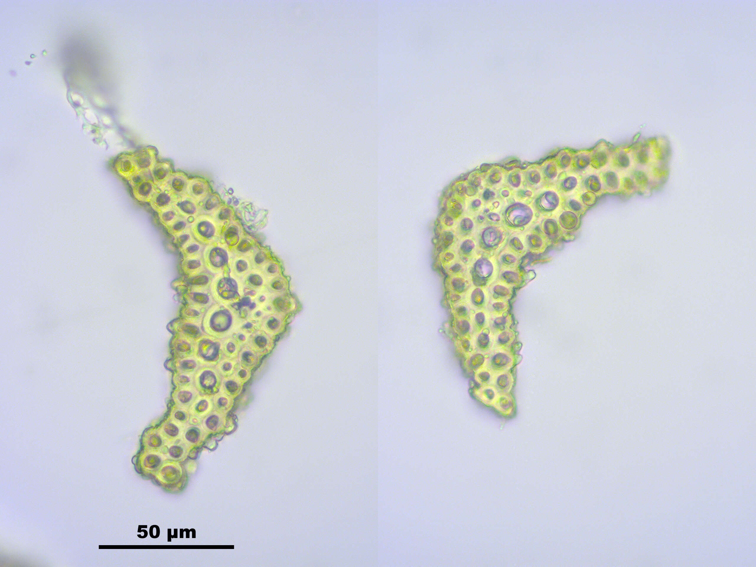 Image of bartramia moss
