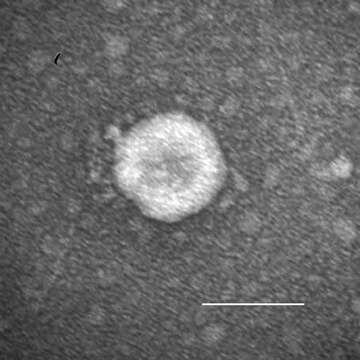 Image of Porcine epidemic diarrhea virus